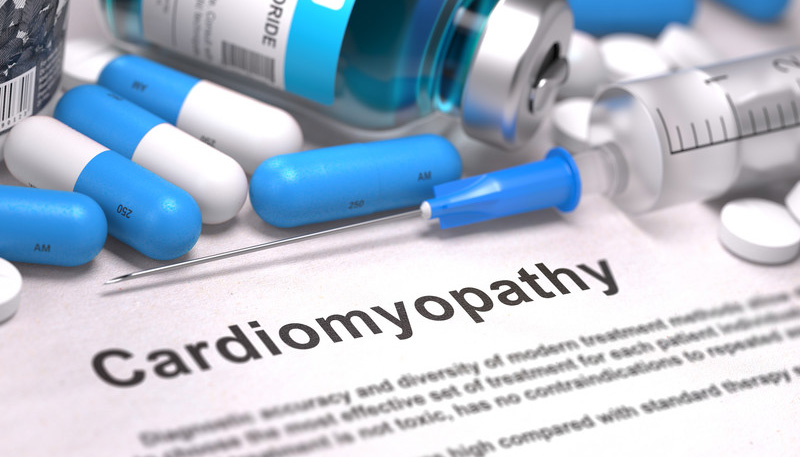 Cardiomyopathy Documentation with Accurate ICD-10-Codes