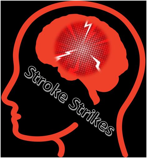 Stroke Strikes.  Season 1 Episode 8.  Stroke