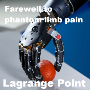 Episode 308 - Farewell to phantom limb pain, and better prostheses