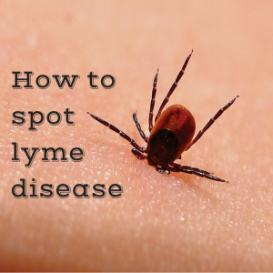 Lyme Disease Awareness: Tick checks and removal.