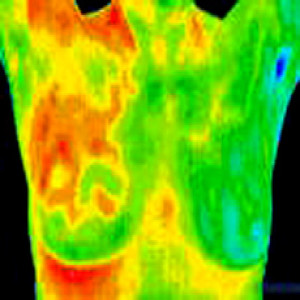 Alternative to mammogram: Thermography