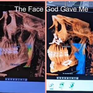 The Face God Gave Me - Rachel's story