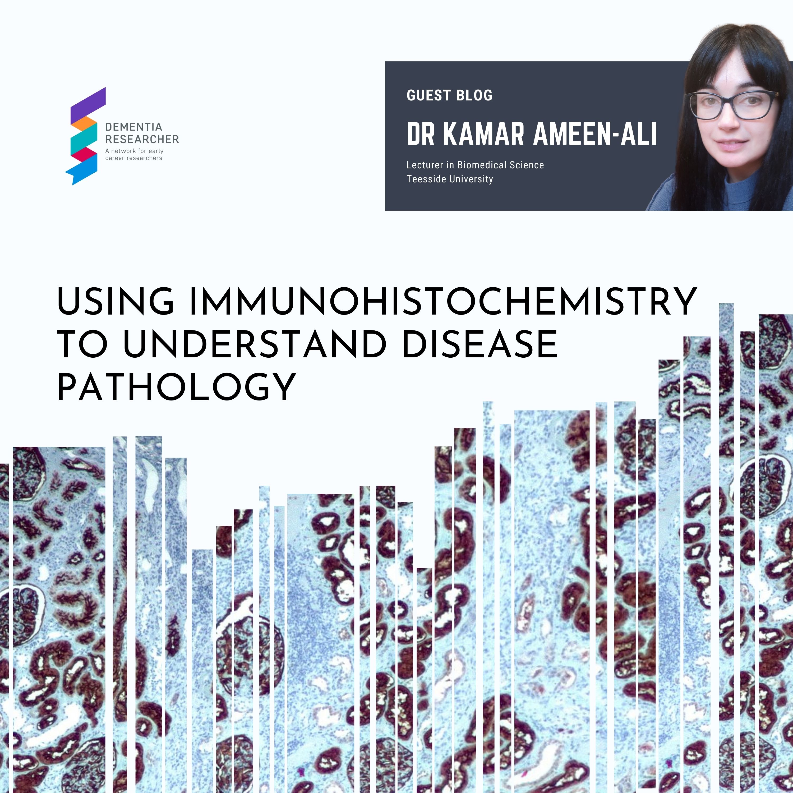 Dementia Researcher Blogs