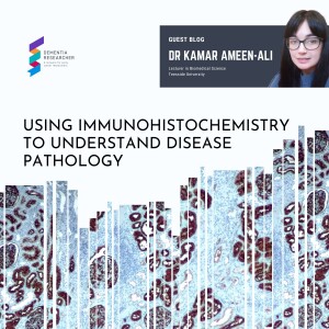 Dr Kamar Ameen-Ali - Using immunohistochemistry to understand disease pathology