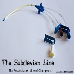 The Subclavian Line: the resuscitation line of champions