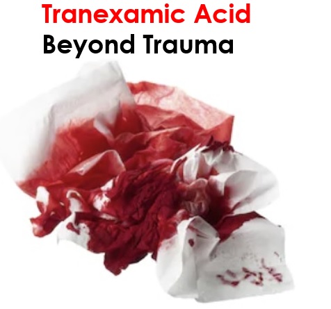 Tranexamic Acid Beyond Trauma
