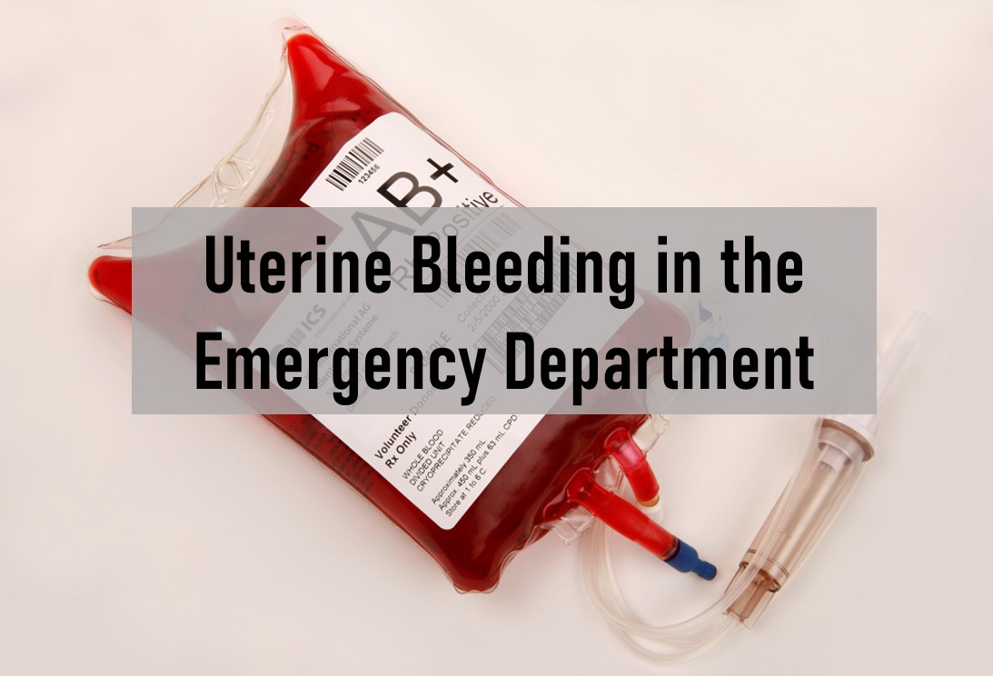 Uterine bleeding in the ED