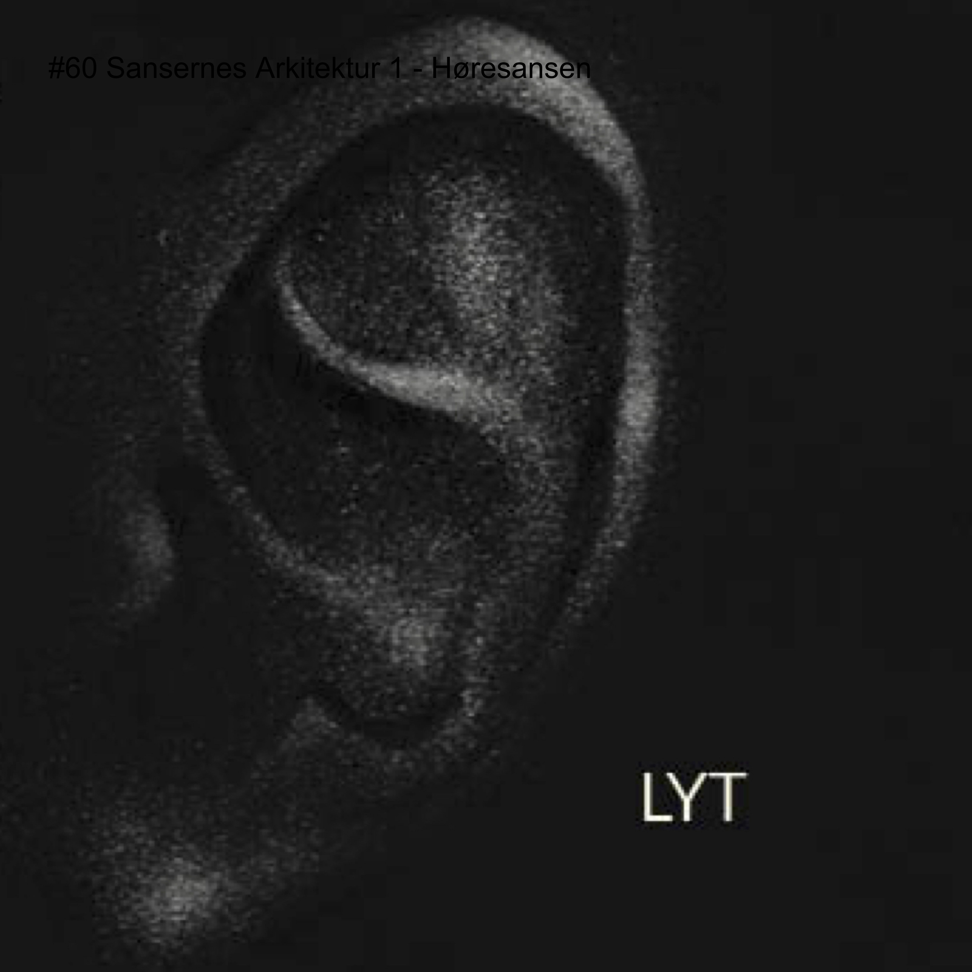 BYLYD