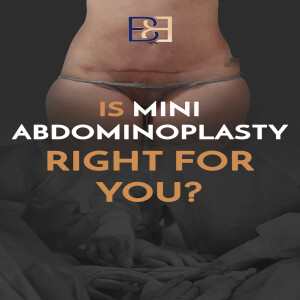 Mini Abdominoplasty: A Faster Recovery With Less Downtime – Find Out If It’s Right for You!