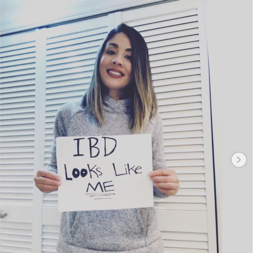 Nicole Candelaria: IBD Journey Part 2 (E58)