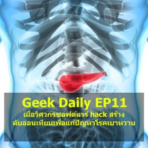 Geek Daily EP11 : เมื่อวิศวกรซอฟต์แวร์ hack สร้างตับอ่อนเทียมเพื่อแก้ปัญหาโรคเบาหวาน