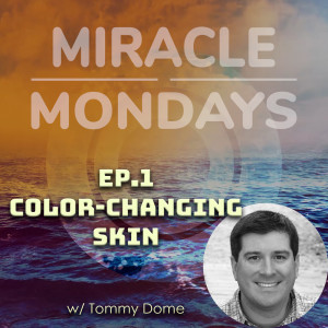 211. Miracle Mondays - Ep.1 - Color-changing skin