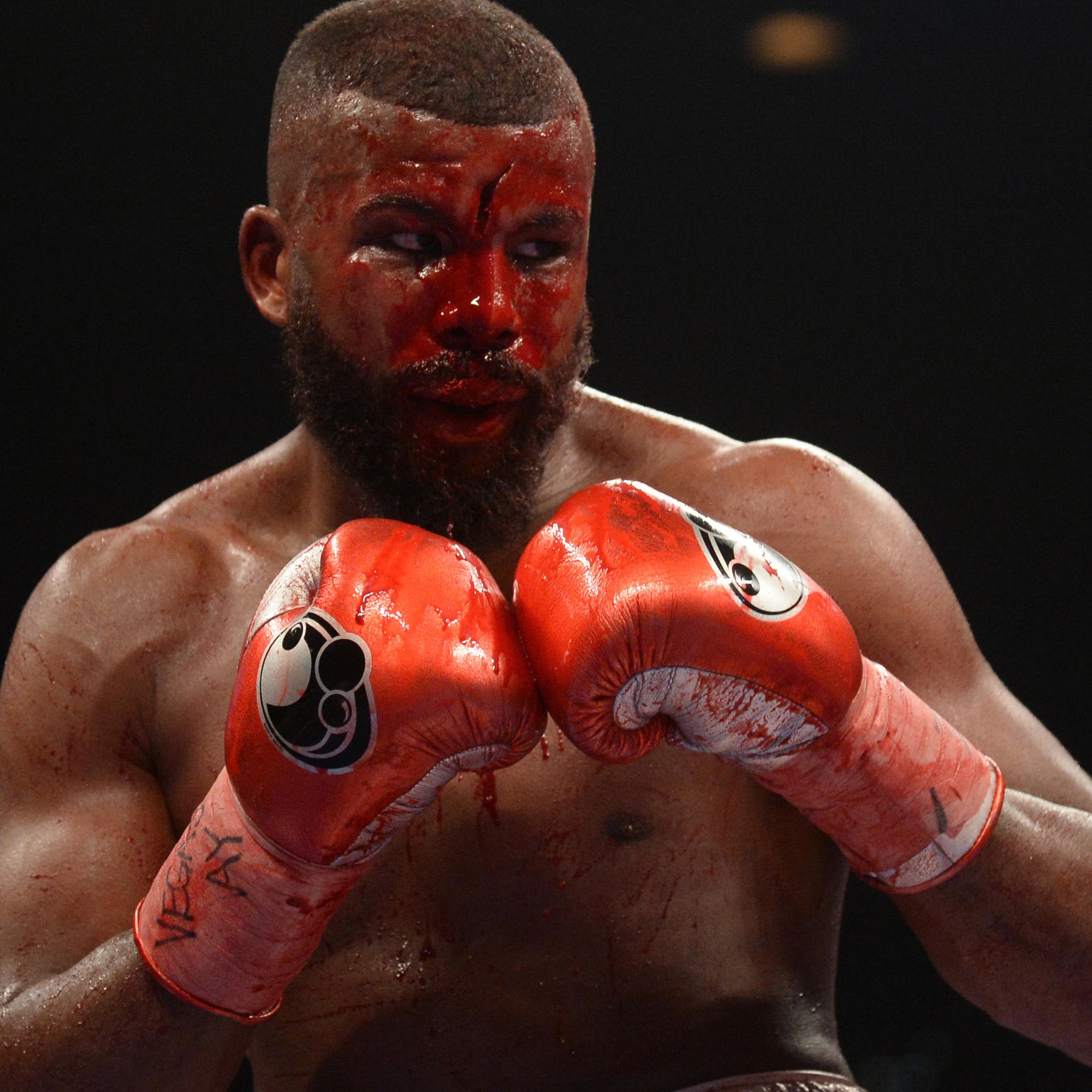 Boxing for the Hood