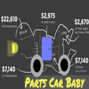 Parts Car Baby