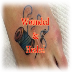 Wounded and Healed (John 20:19-31)