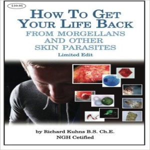 How to Get Your Life Back from Morgellons and Other Skin Parasites