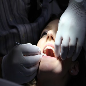 Teeth whitening Alexandria
