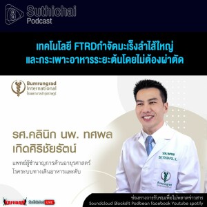 Suthichai Podcast เทคโนโลยี FTRDกำจัดมะเร็งลำไส้ใหญ่และกระเพาะอาหารระยะต้นโดยไม่ต้องผ่าตัด