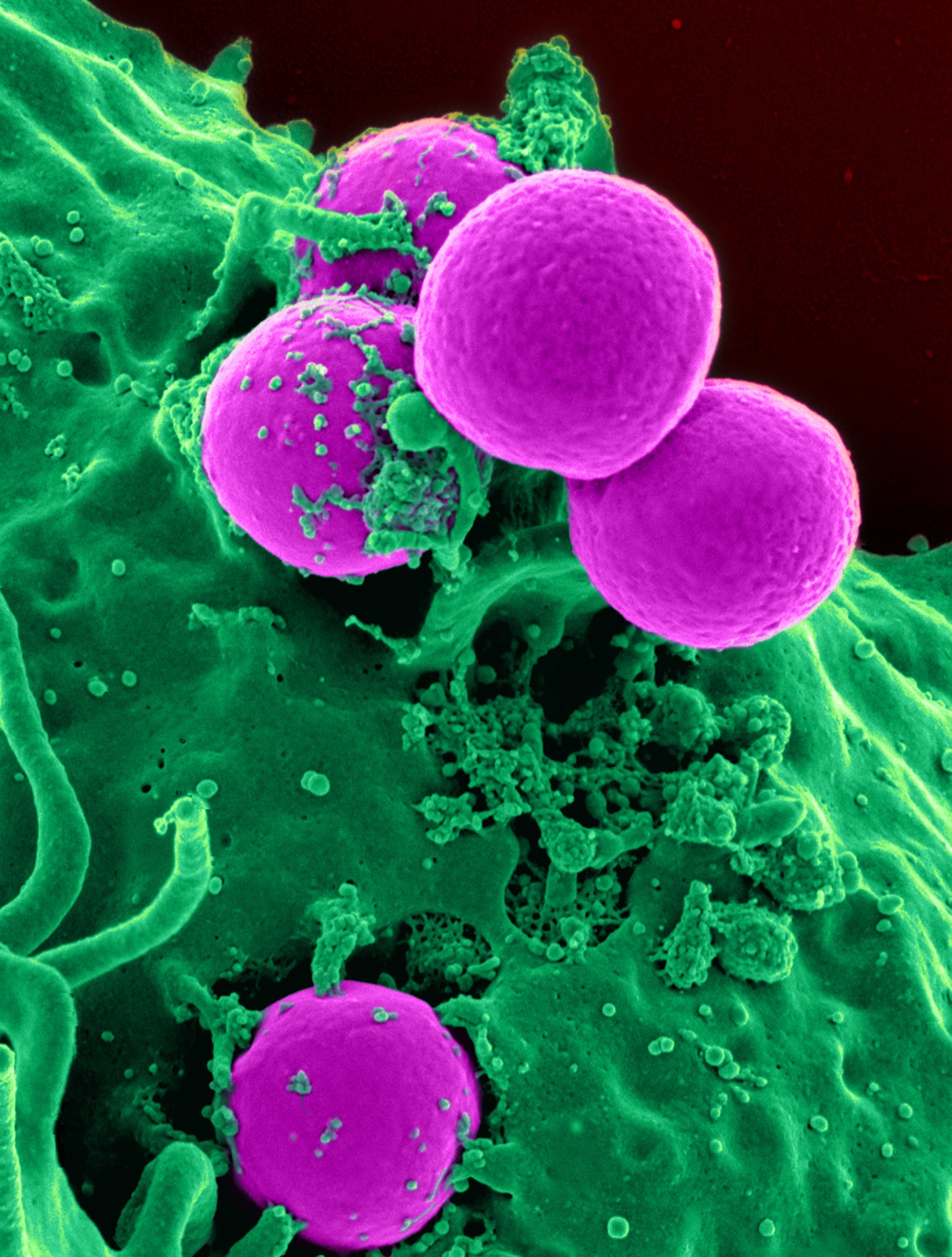 On Gene Therapy