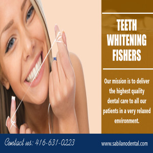 Teeth Whitening Fishers