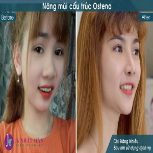 nang mui s line osteno