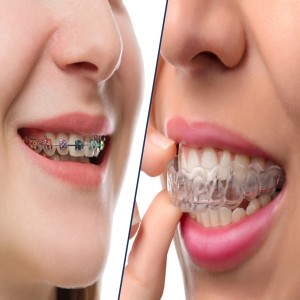 Best Dental Care Tips From Summerlin Dental Solutions