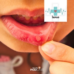 โรงหมอ EP. 469: แผลในช่องปาก เป็นบ่อย ๆ อันตรายไหม