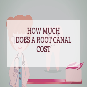 How Much Does A Root Canal Cost in the USA?