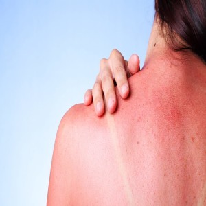Episode 92: Safe Sun Protection, Sunburn Recovery, & Your Covid/Vaccine Questions!