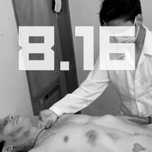 S8E16 - Zombies AmongUs | premature burials & lazarus syndrome