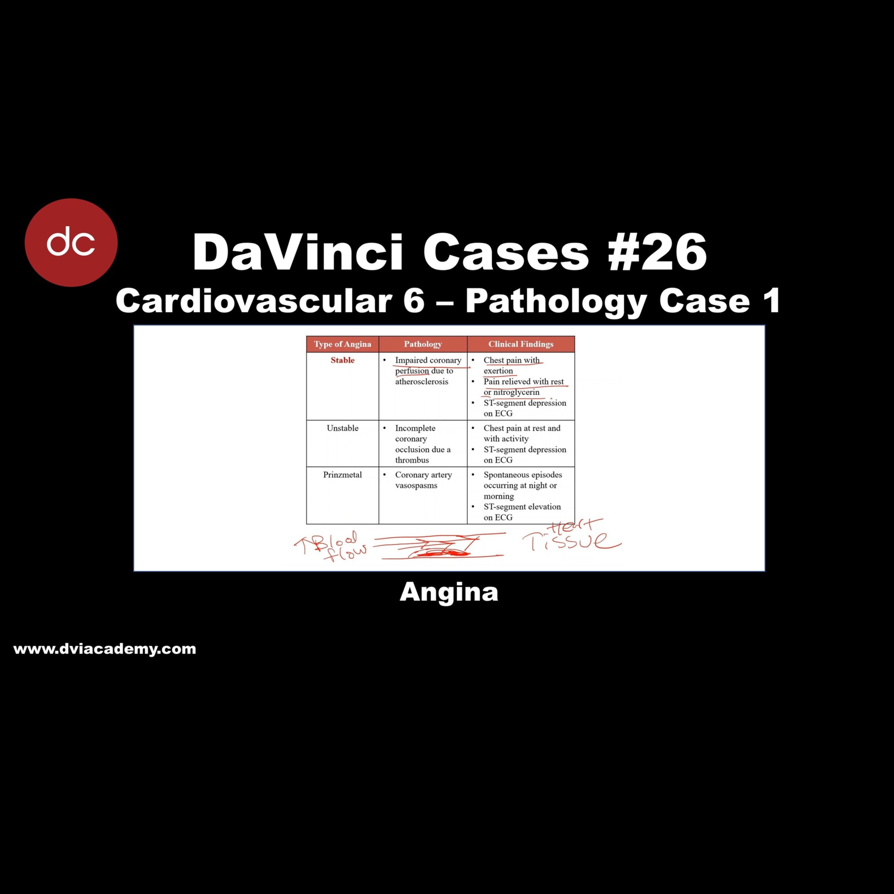 #DaVinciCases