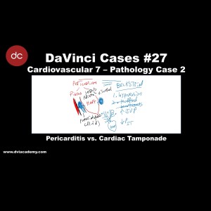 Pericarditis vs. Cardiac Tamponade [#DaVinciCases Cardiovascular 7 - Pathology Case 2]
