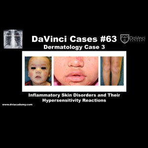 Inflammatory Skin Disorders and Hypersensitivity Reactions  [#DaVinciCases Dermatology Case 3]