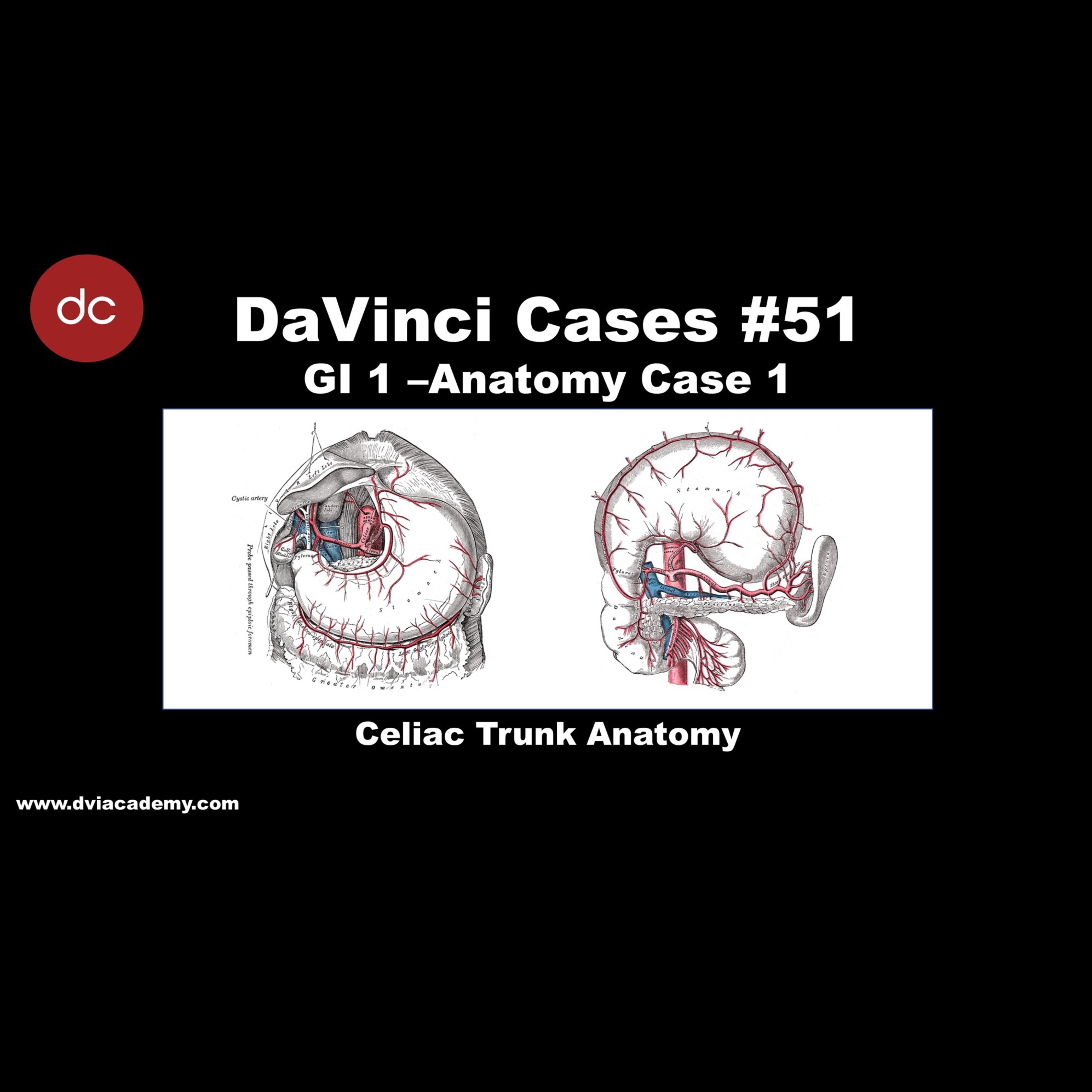 #DaVinciCases