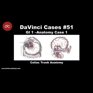 Celiac Trunk Anatomy Case [#DaVinciCases GI 1 - Anatomy Case 1]