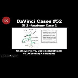 Cholecystitis vs Choledocholithiasis vs Ascending Cholangitis [#DaVinciCases GI 2 - Anatomy Case 2]
