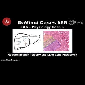 Acetaminophen Toxicity and Liver Zone Physiology [#DaVinciCases GI 5 - Physiology Case 3]