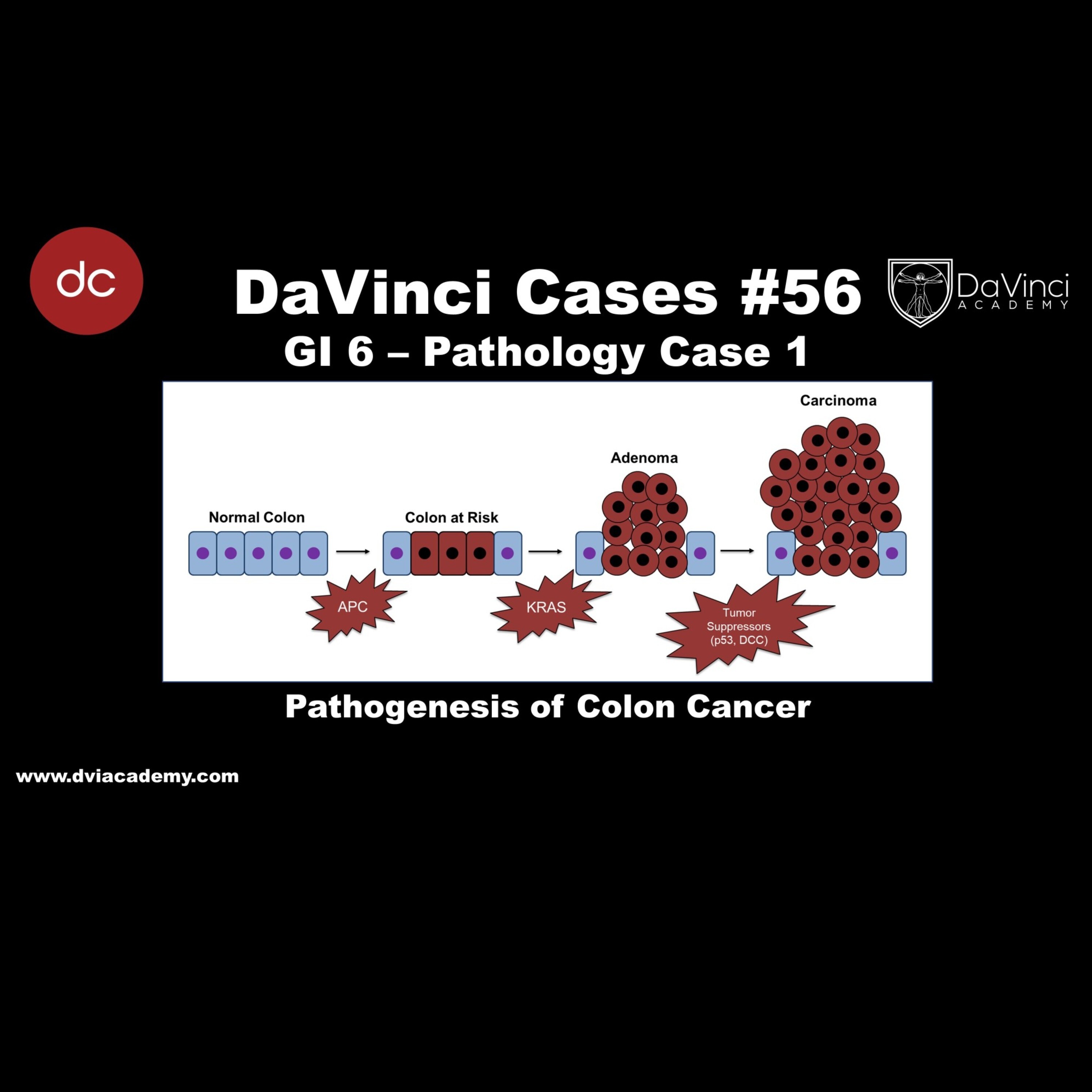 #DaVinciCases