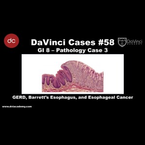 GERD, Barrett’s Esophagus, and Esophageal Cancer [#DaVinciCases GI 8 - Pathology Case 3]