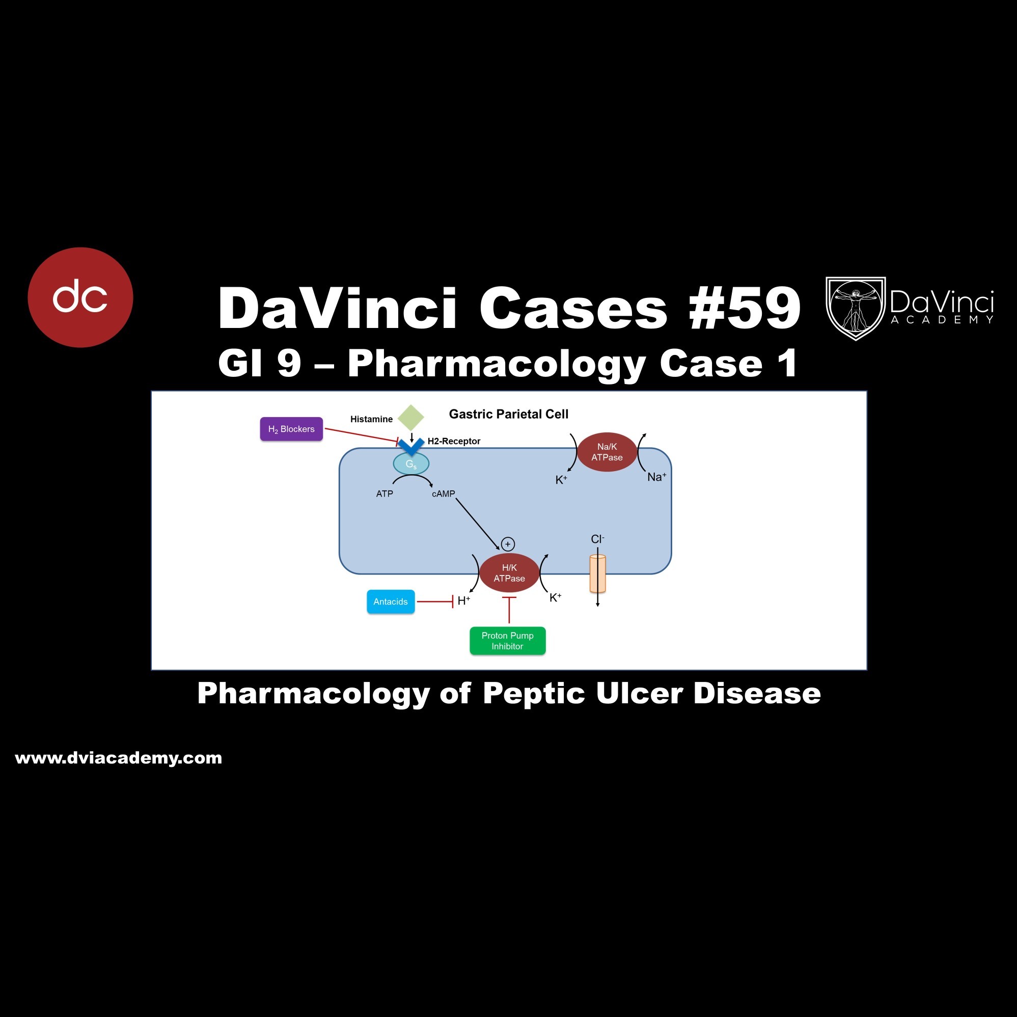 Pharmacology of Peptic Ulcer Disease [#DaVinciCases GI 9 - Pharmacology Case 1]