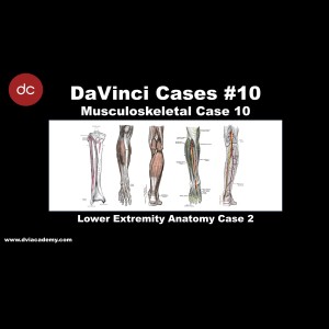 #DaVinciCases Musculoskeletal 10 - Lower Extremity Anatomy 2
