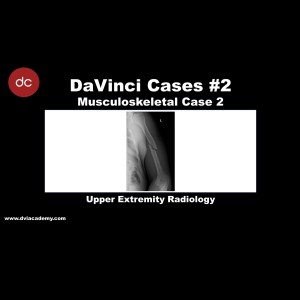 #DaVinciCases Musculoskeletal 2 - Upper Extremity Radiology