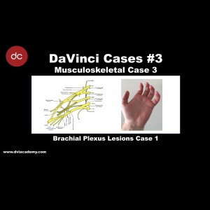#DaVinciCases Musculoskeletal 3 - Brachial Plexus 1