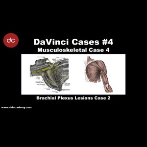 #DaVinciCases Musculoskeletal 4 - Brachial Plexus 2