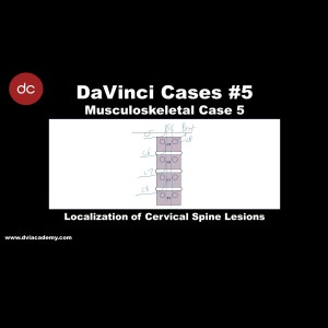 #DaVinciCases Musculoskeletal 5 - Spine Anatomy 1
