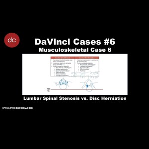 #DaVinciCases Musculoskeletal 6 - Spine Anatomy 2