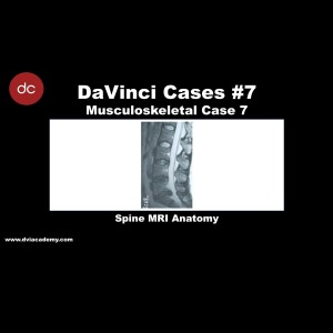 #DaVinciCases Musculoskeletal 7 - Spine Radiology 1