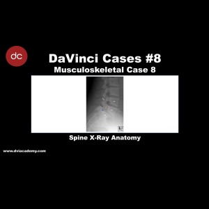 #DaVinciCases Musculoskeletal 8 - Spine Radiology 2