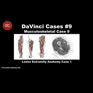 #DaVinciCases Musculoskeletal 9 - Lower Extremity Anatomy 1