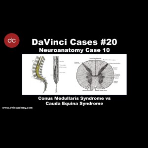 Conus Medullaris Syndrome vs. Cauda Equina Syndrome [#DaVinciCases Neuroanatomy 10 - Neurotrauma Case 2]